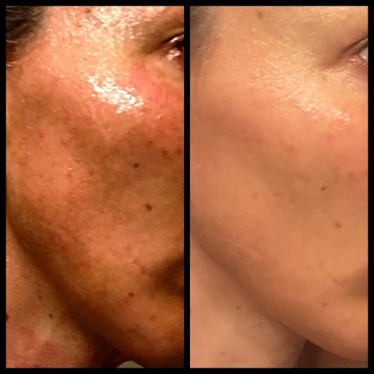 Anti-Aging skincare and Peptides. Hype or the real thing?