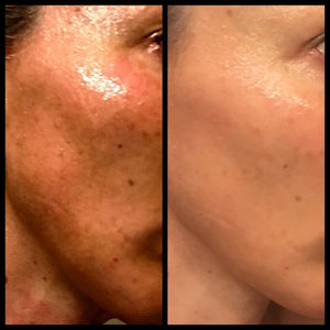 Anti-Aging skincare and Peptides. Hype or the real thing?